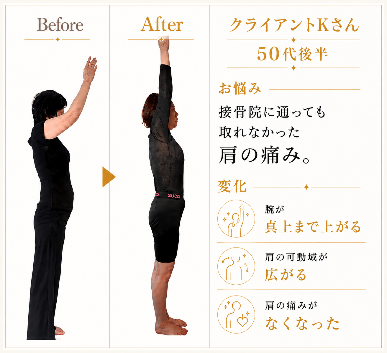 マシンピラティスによるビフォーアフター実績3