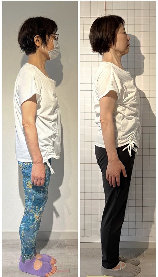 お客様のビフォーアフター（横から見た立ち姿。左がBefore、右がAfter）