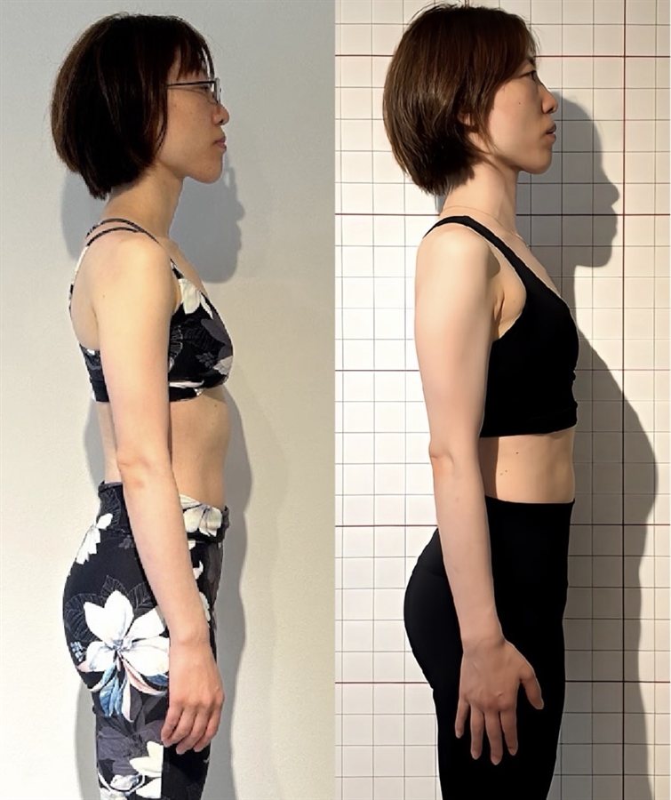 お客様のビフォーアフター（横から見た上半身。左がBefore、右がAfter）