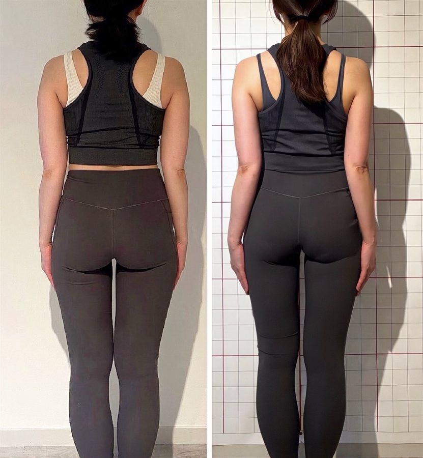 お客様のビフォーアフター（後ろから見た立ち姿。左がBefore、右がAfter）