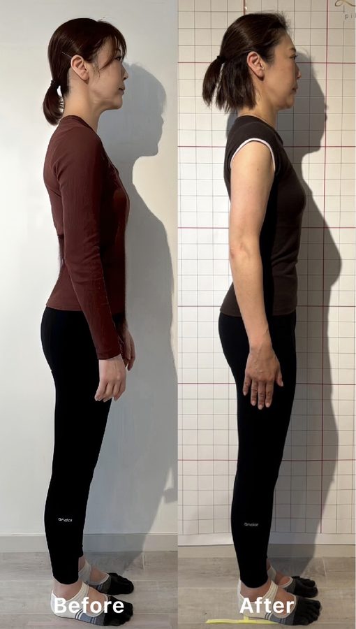 お客様のビフォーアフター（横から見た立ち姿。左がBefore、右がAfter）