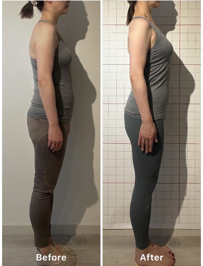 お客様のビフォーアフター（横から見た立ち姿。左がBefore、右がAfter）